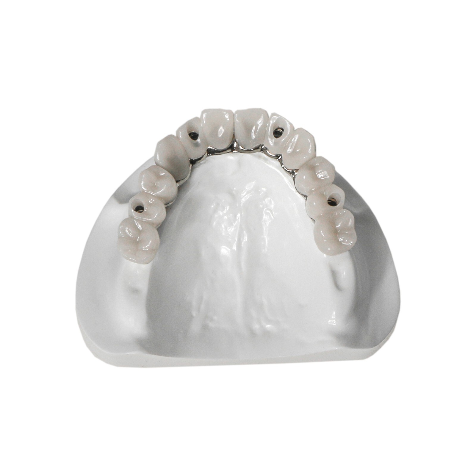 Dental Typodont Teeth Model Implant Pathological Perio Restoration Practice Demo