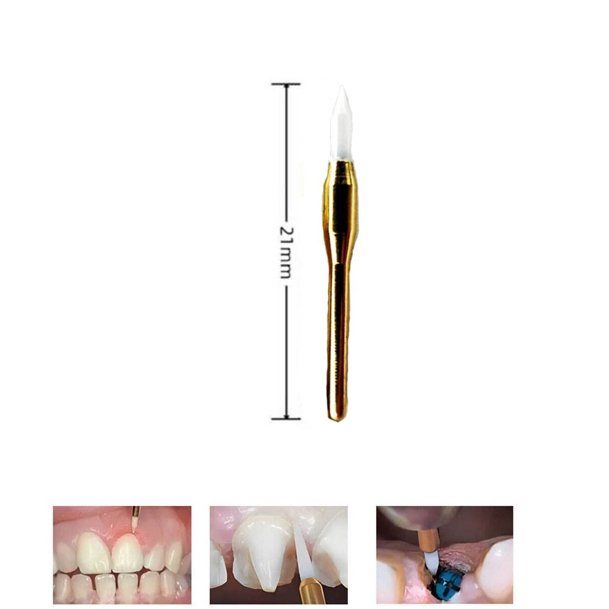 Precision Dental Surgical Soft Tissue Trimmer, 21mm Gum Cutter Bur