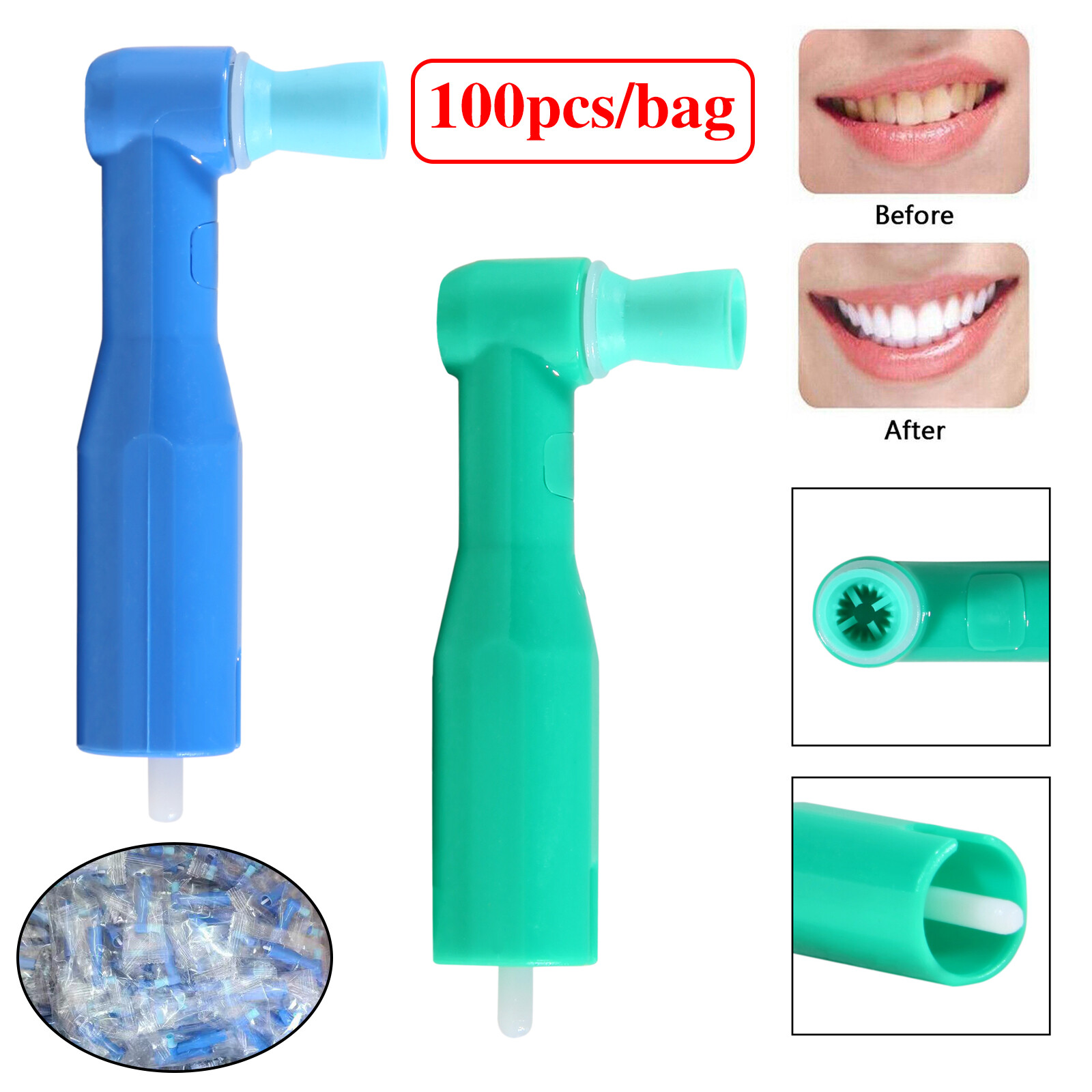 Dental Orthodonti Elastic Ligature Ties Bands for Brackets Braces Rubber Ring