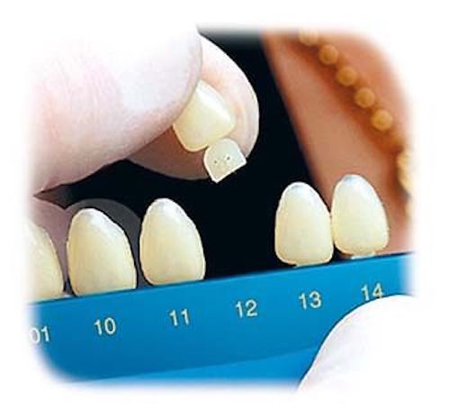 Dental Polycarbonate Temporary Crowns 5 pcs #35