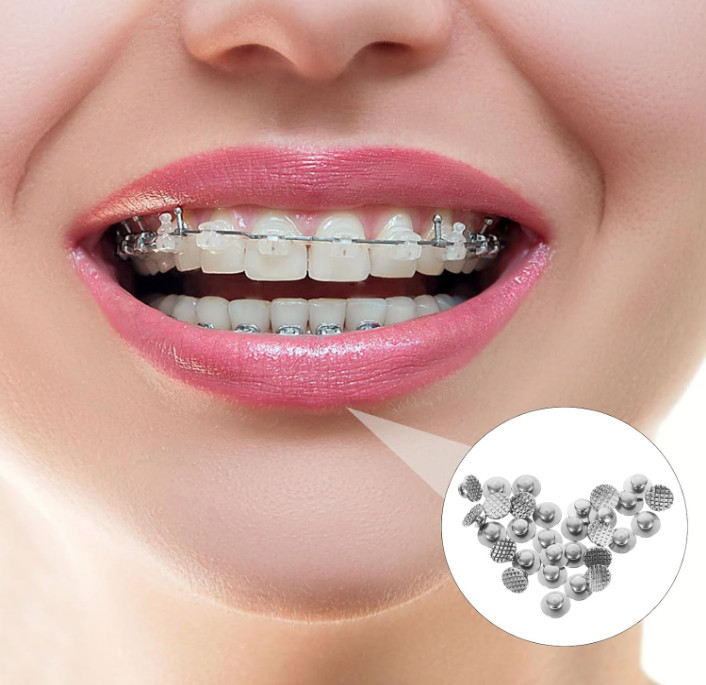 US Dental Ortho Lingual Buttons Bondable Round Mesh Base Metal/Ceramic Composite