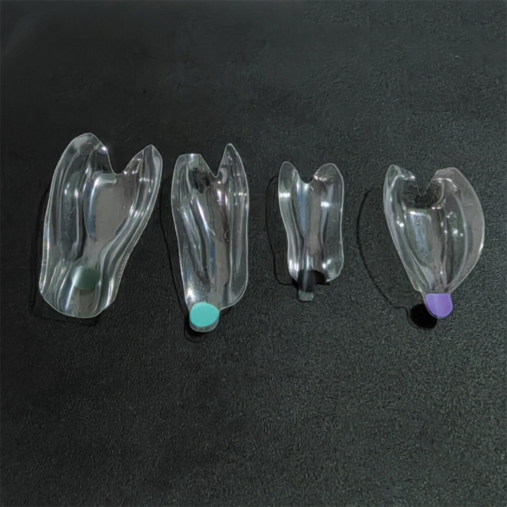 Clear Matrix Dental BT Matrices Black Triangle Wedges Diastema Fits BioClear