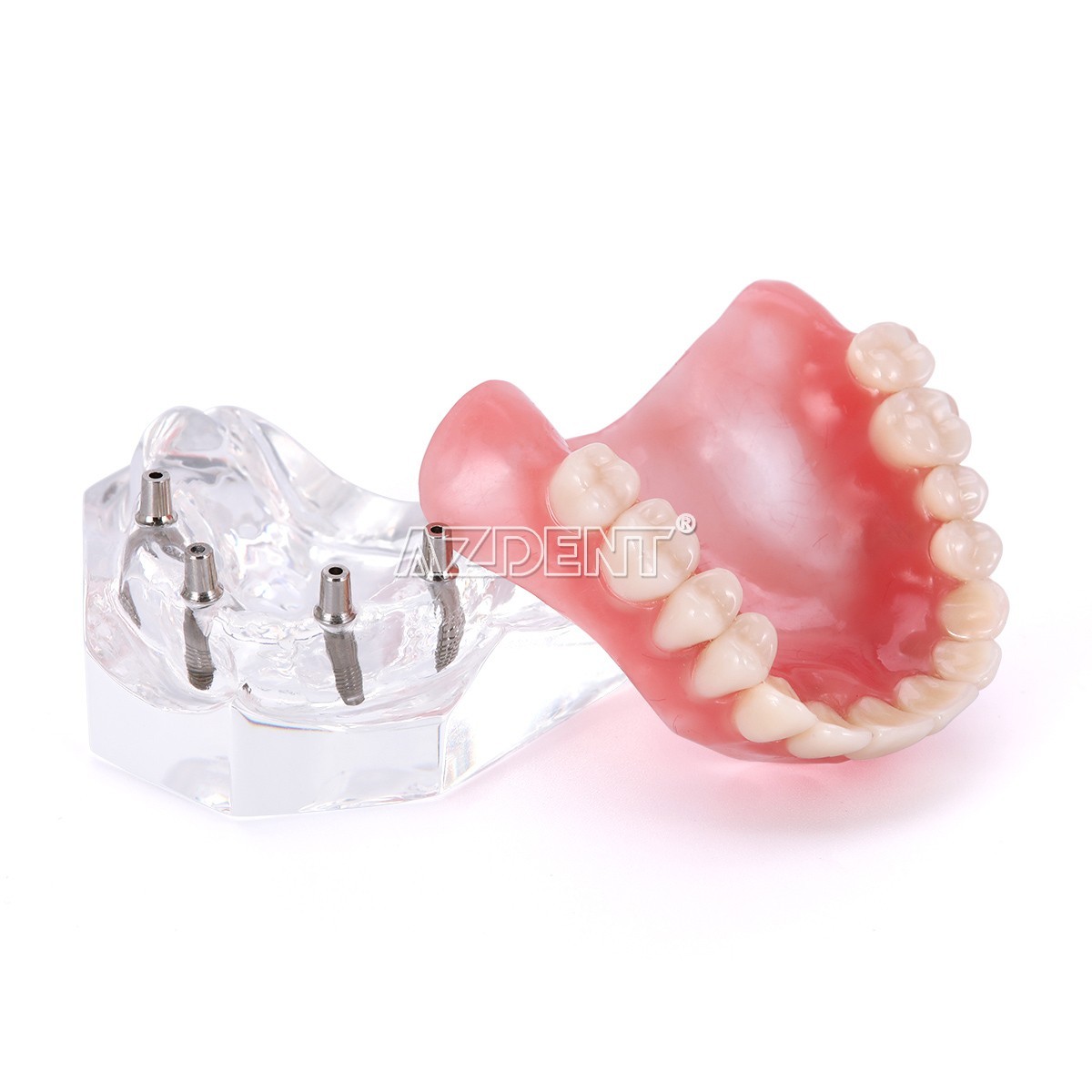 Dental Implant Teeth Model Demo Overdenture Restoration With Implants Lower 6003