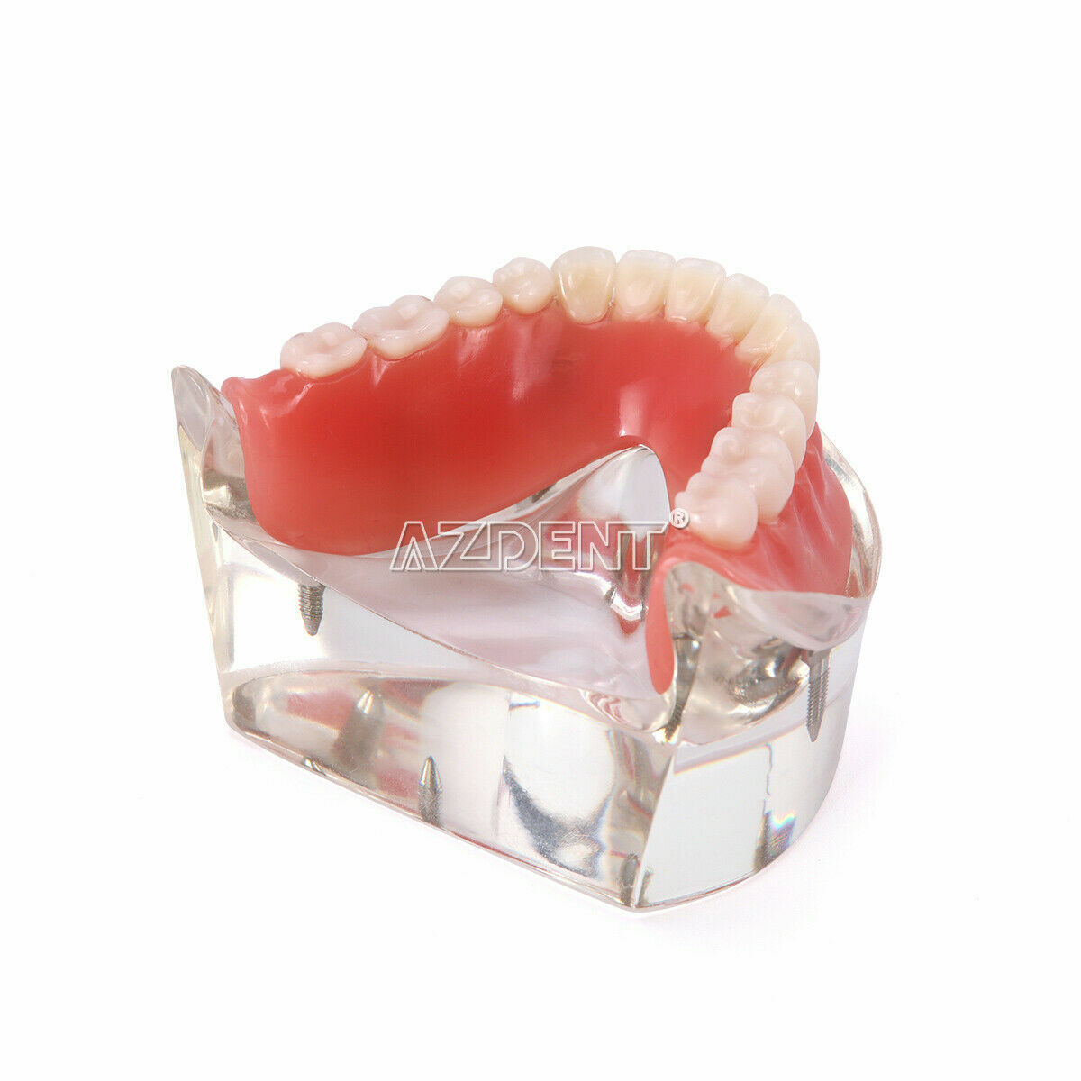 Dental Demonstration 4 Implants Teeth Model Typodont Inferior Overdenture Lower