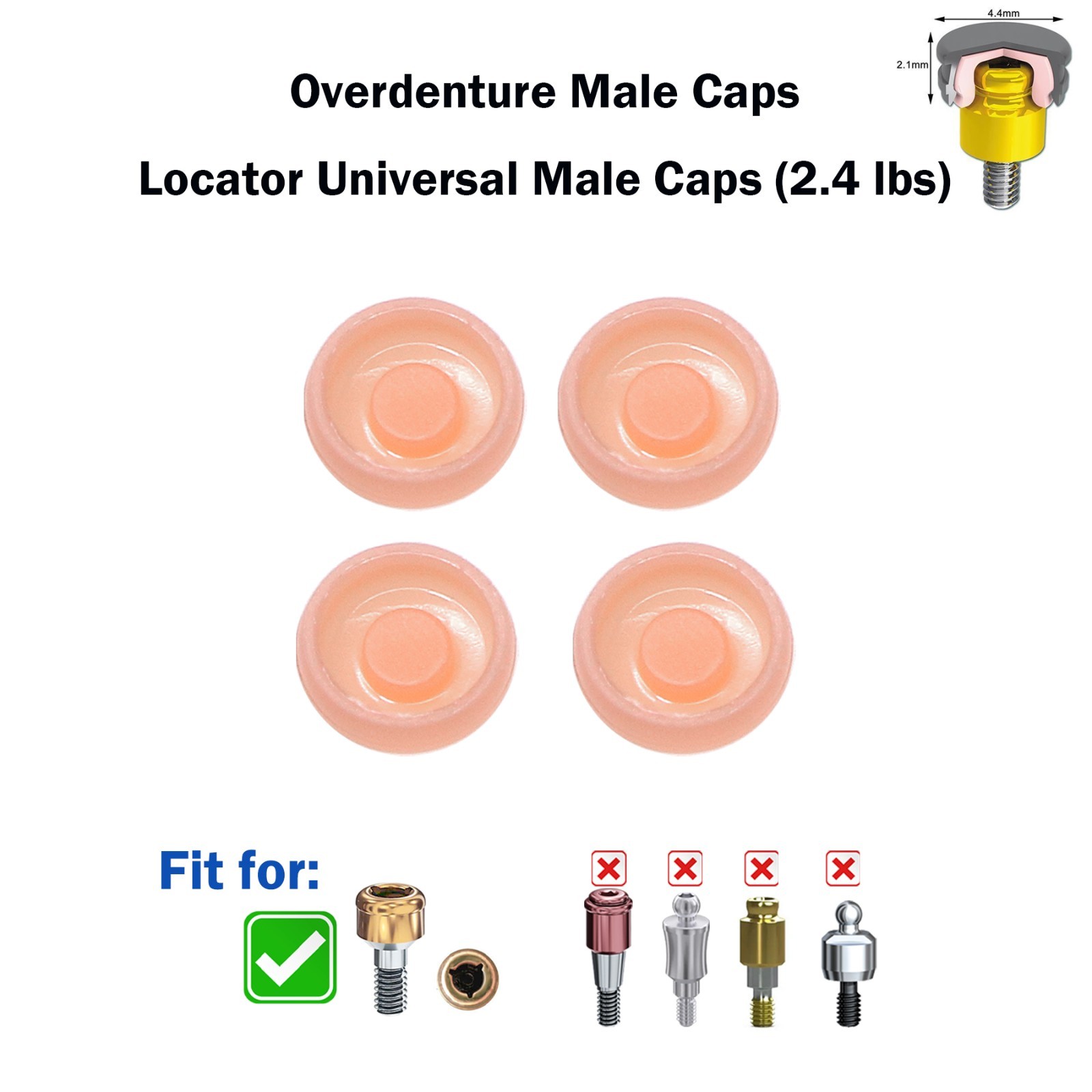 Universal Dental Overdenture Retention Male Caps Insert for Zest Locator System