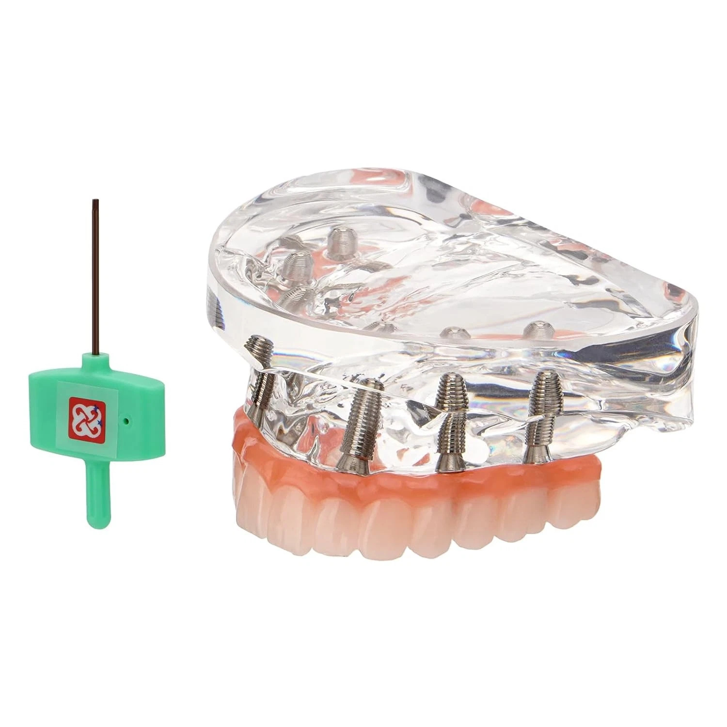 Dental Overdenture Implant Model All-on-4/6 Upper Jaw Restoration 4/6 Screws
