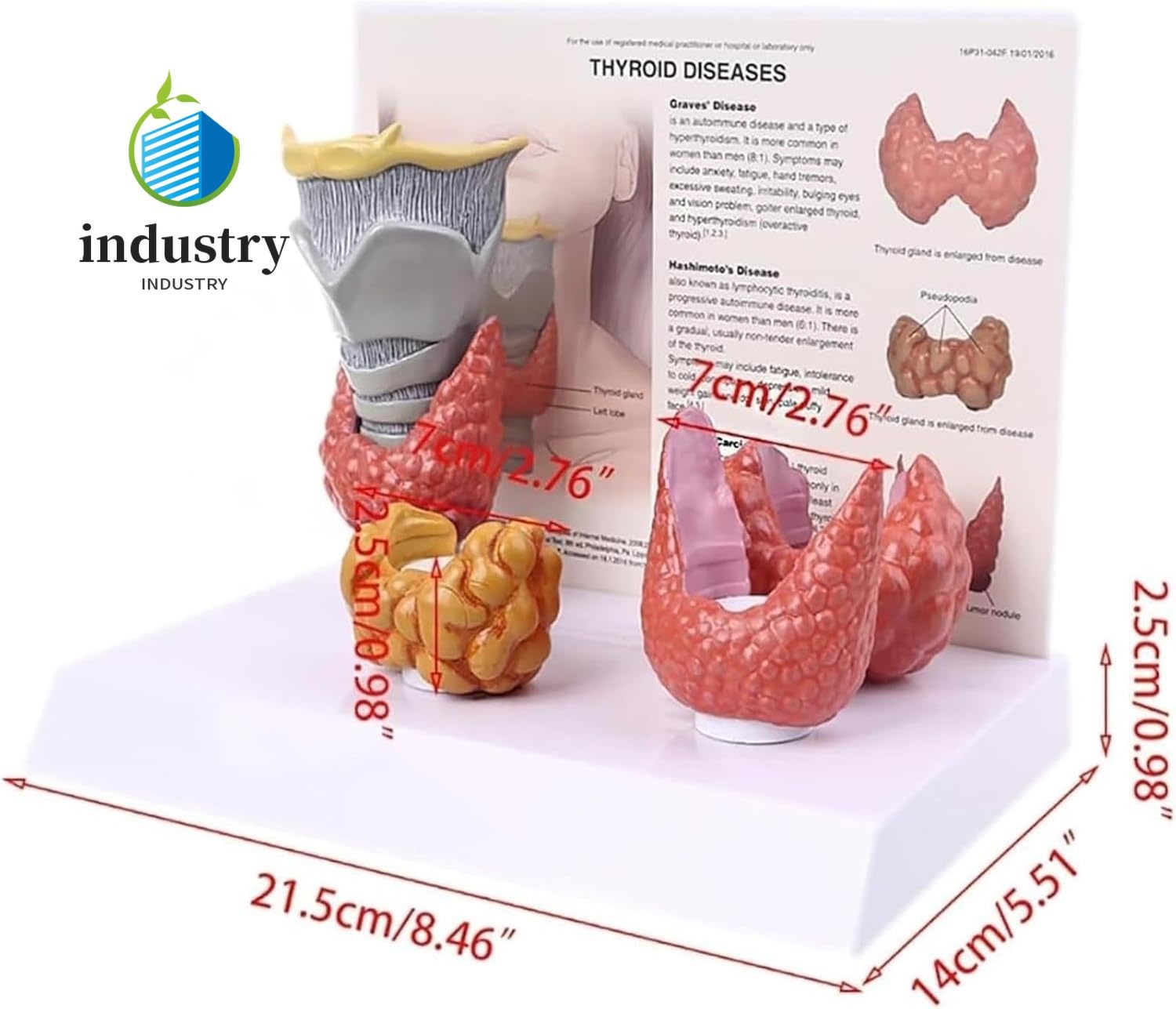 4pcs Set of Human Thyroid Pathological Anatomical Models Throat and Thyroid