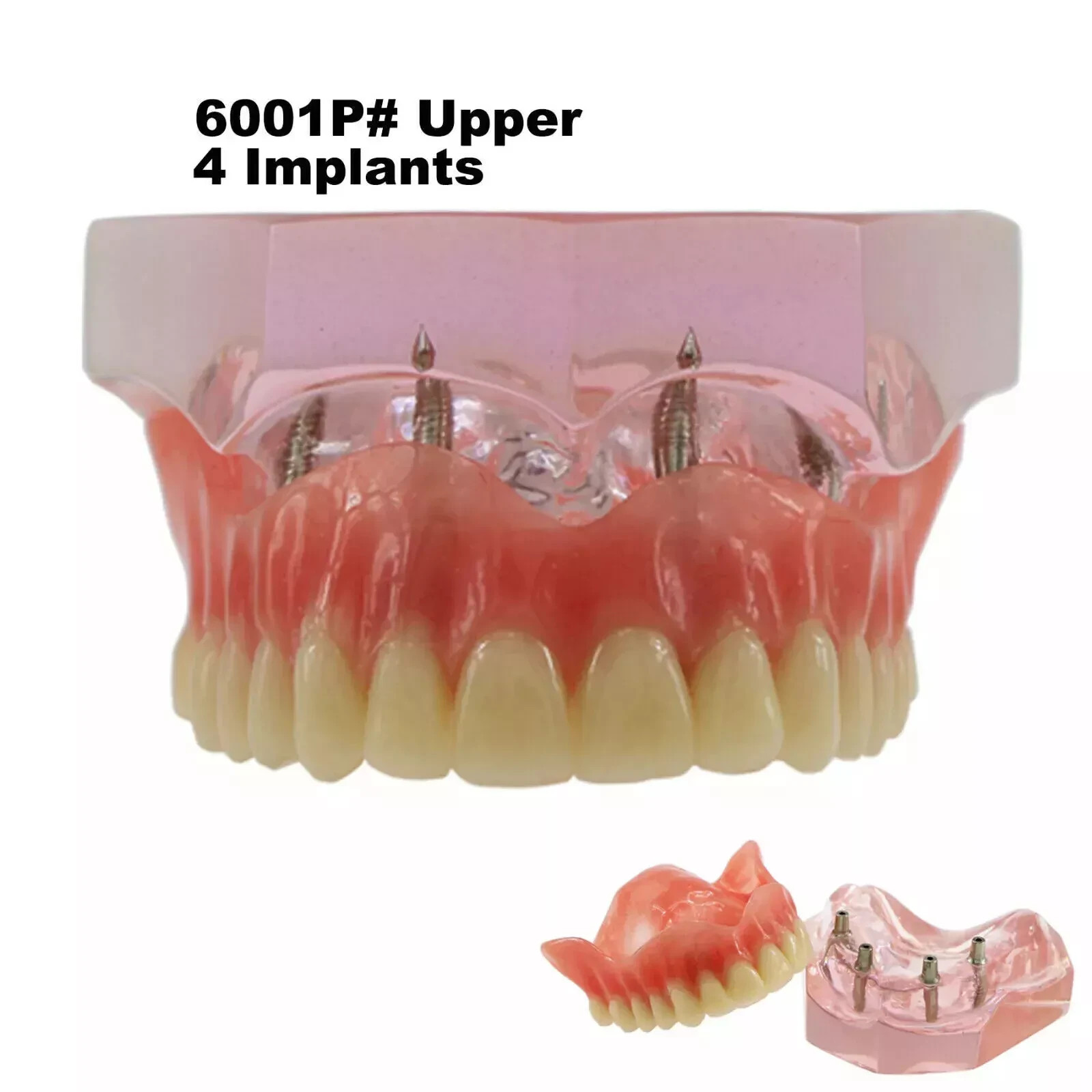 Dental Orthodontic Teaching Implant Overdenture Restoration Education Teeth Mode