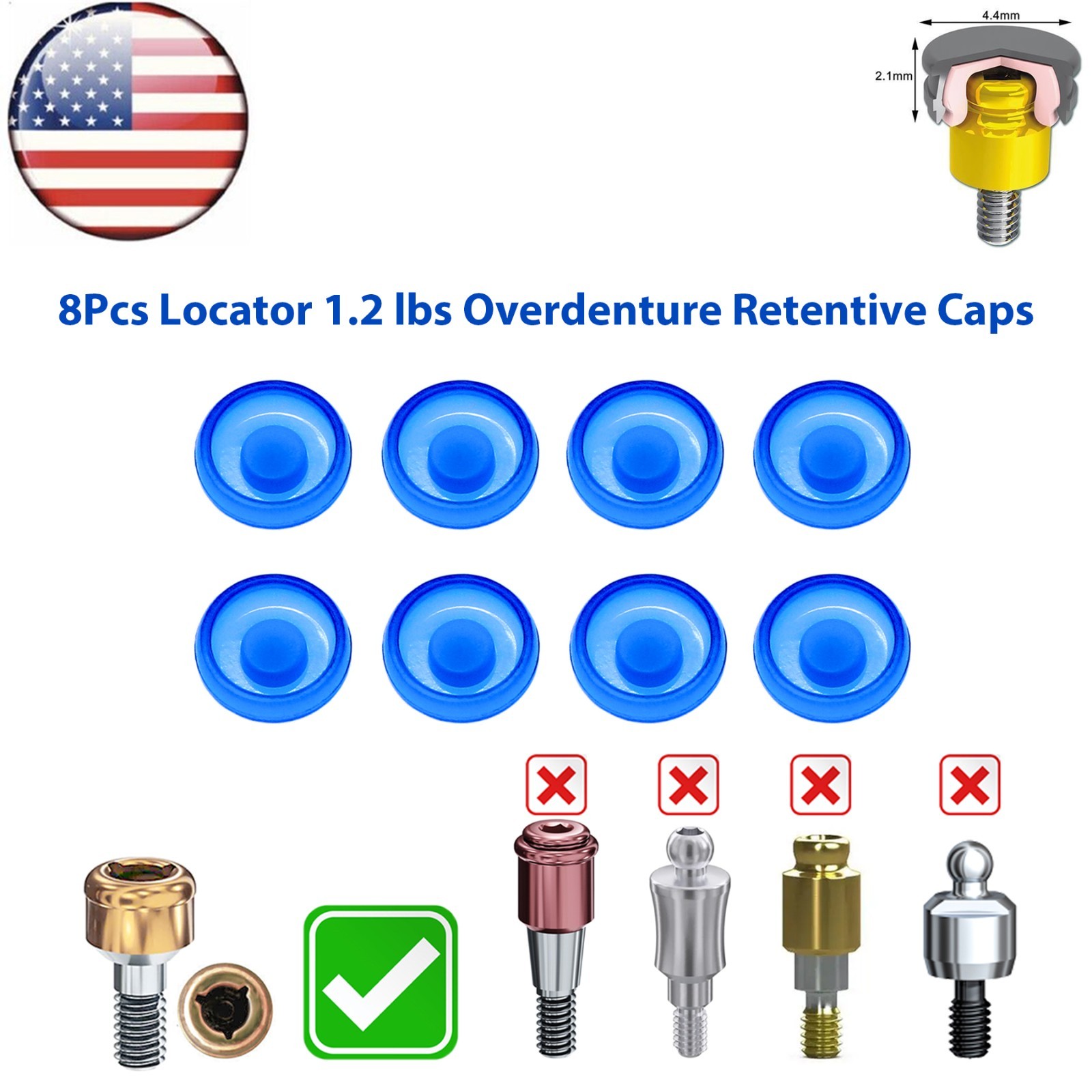 US Dental Overdenture Locator Universal Implant Retention Caps 1.2lbs Blue
