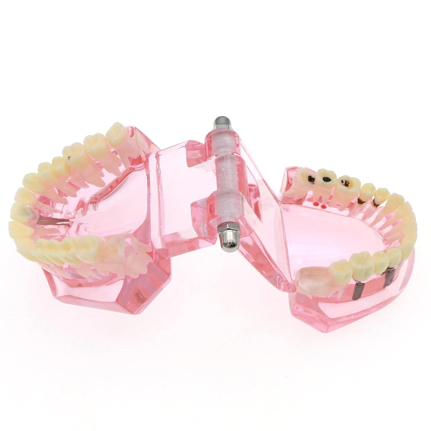 Dental Teeth Model Teach for Study Demo Restoration Pathology Bridge M2001 Pink
