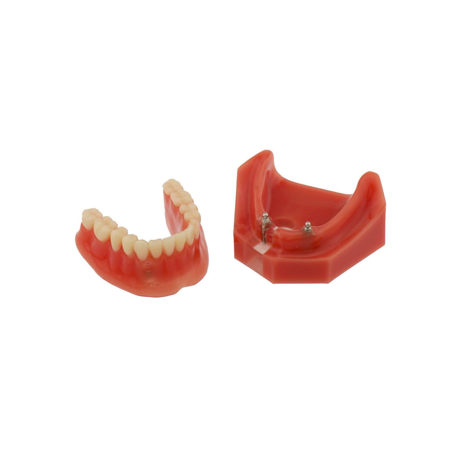 Dental Implants Restoration Model Overdenture Inferior With Demo Teaching Study