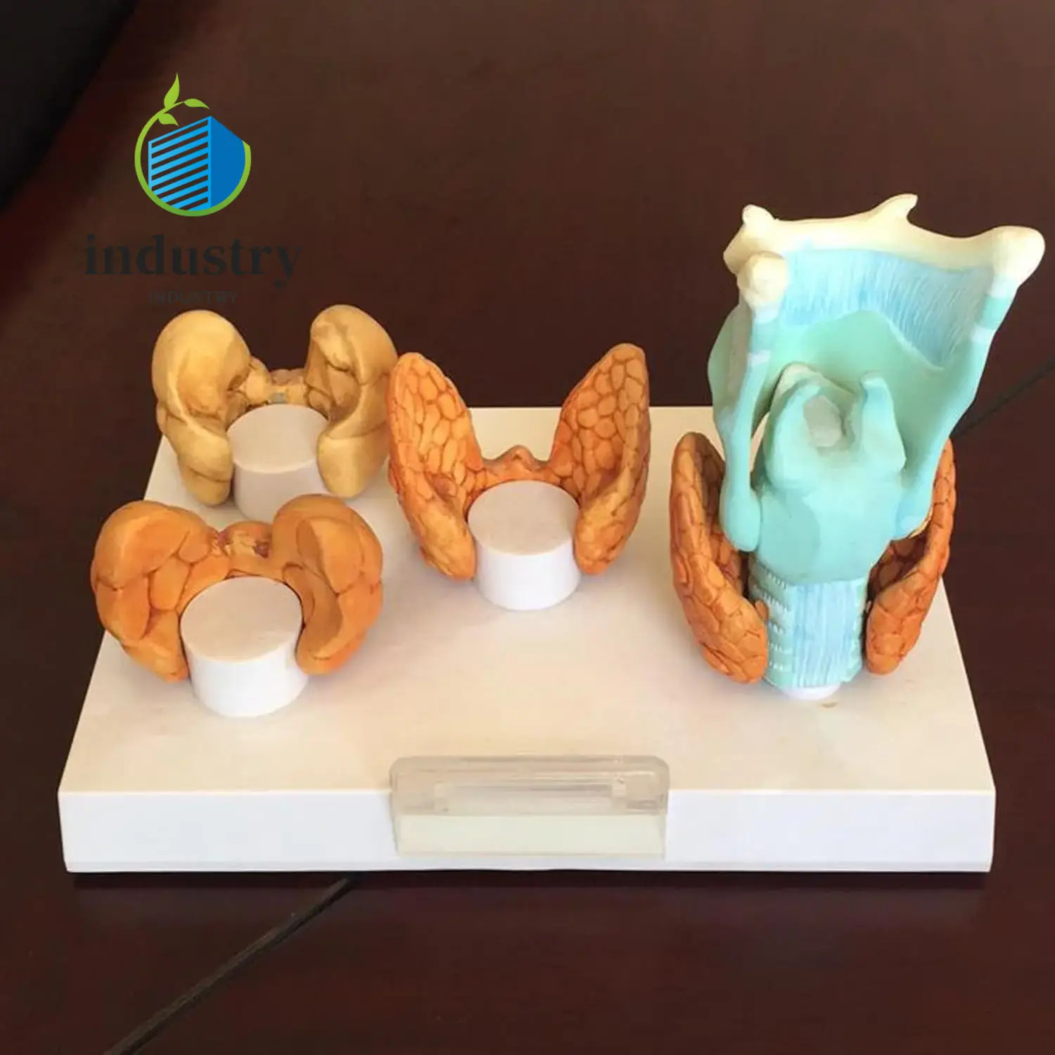 4pcs Set of Human Thyroid Pathological Anatomical Models Throat and Thyroid