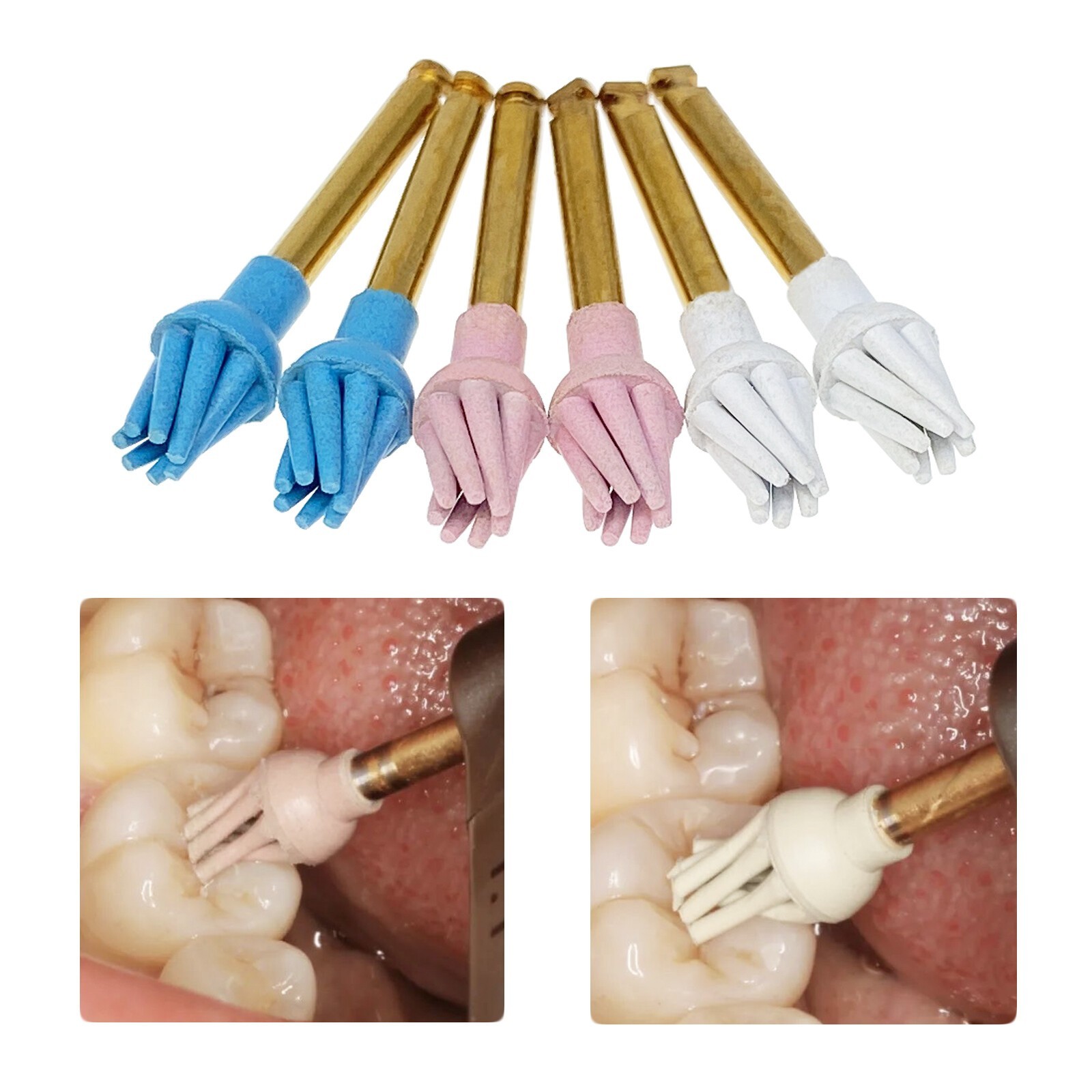 Dental Rubber Polishing Wheel Spiral Flex RA Polishing Burs Coarse/Medium/Fine