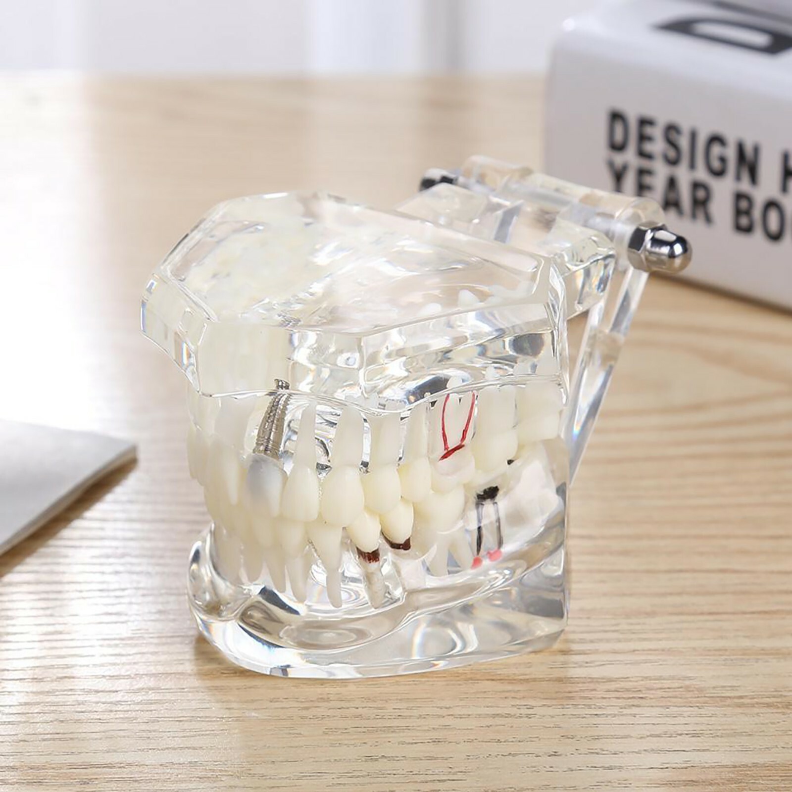Dental Implant Typodonts Teeth Model Restoration Pathology Teach Study M2001C