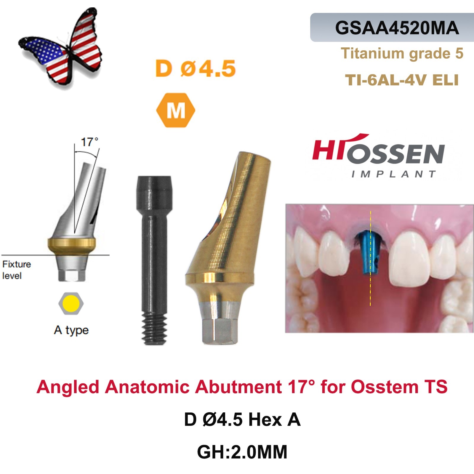 US 17° Angulated Abutment Mini/Regular Hex A/B Transfer Fit Osstem TS/Hiossen ET