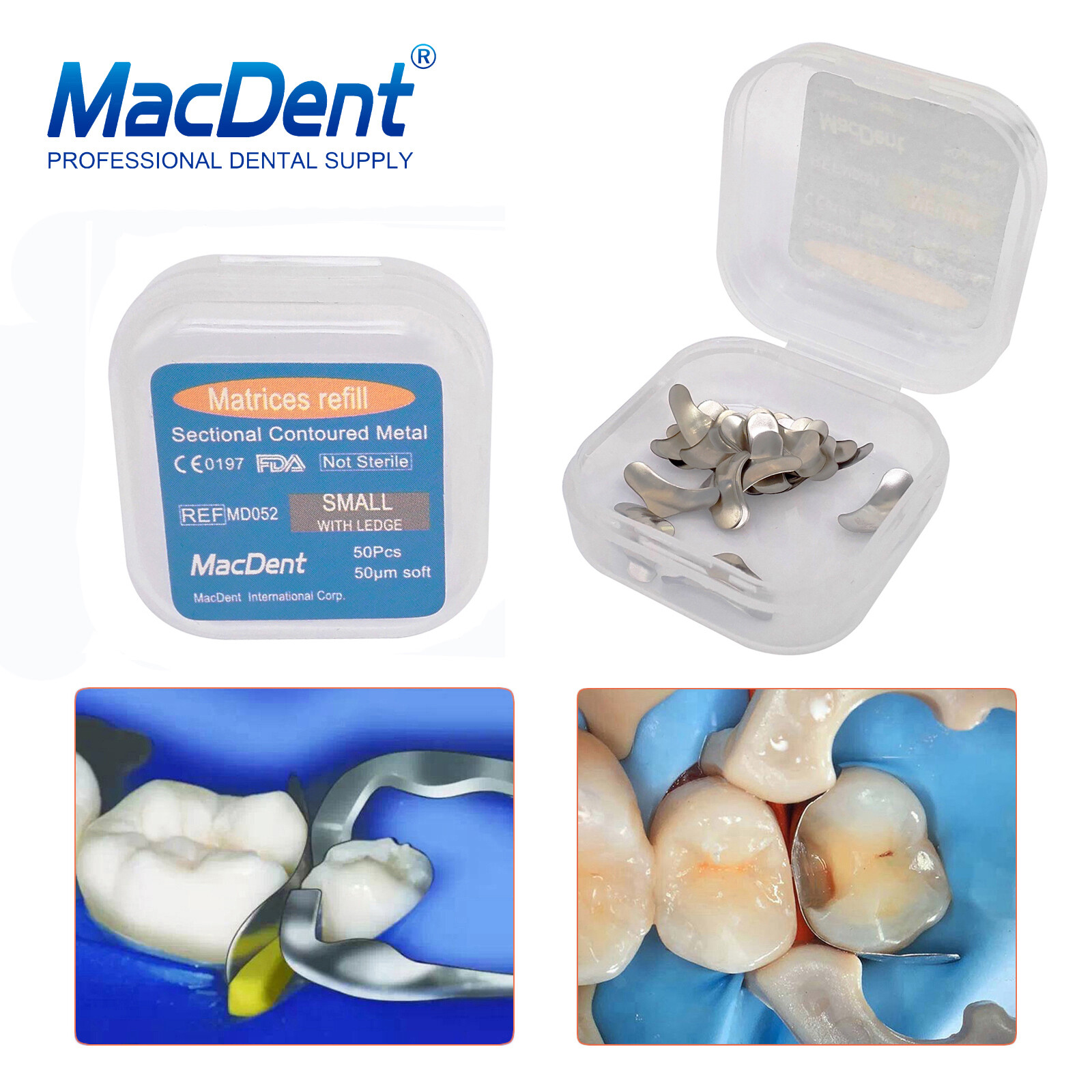 100×Dental Matrices Sectional Contoured Metal Soft Band Matrix Refill 50μm S/M/L