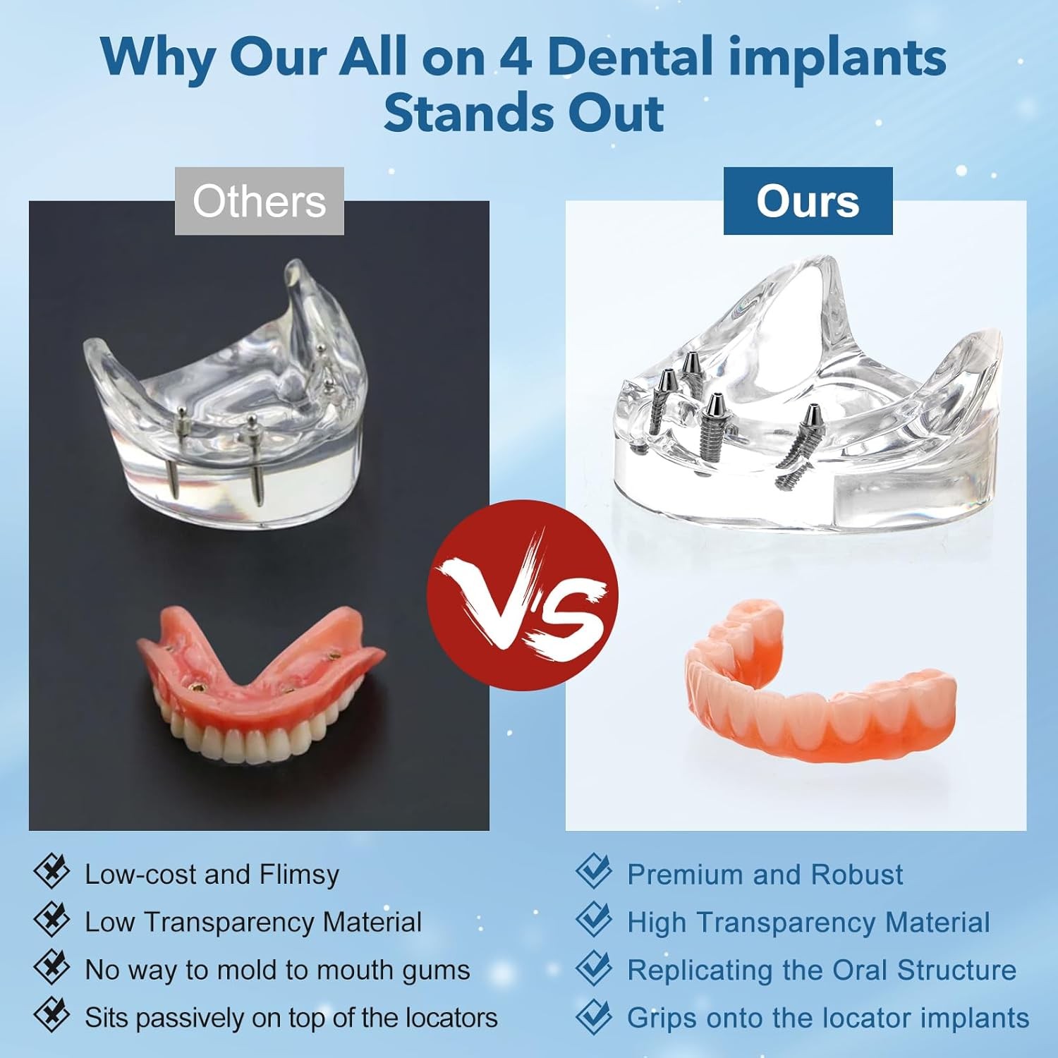 Dental Implant Model Overdenture All-on-4 All-on-6 treatment Demo With 4/6 Screw