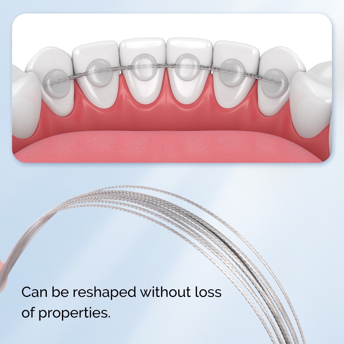 Dental Ortho Super Elastic Niti /Stainless Steel Arch Wire/Lingual Retainer Wire