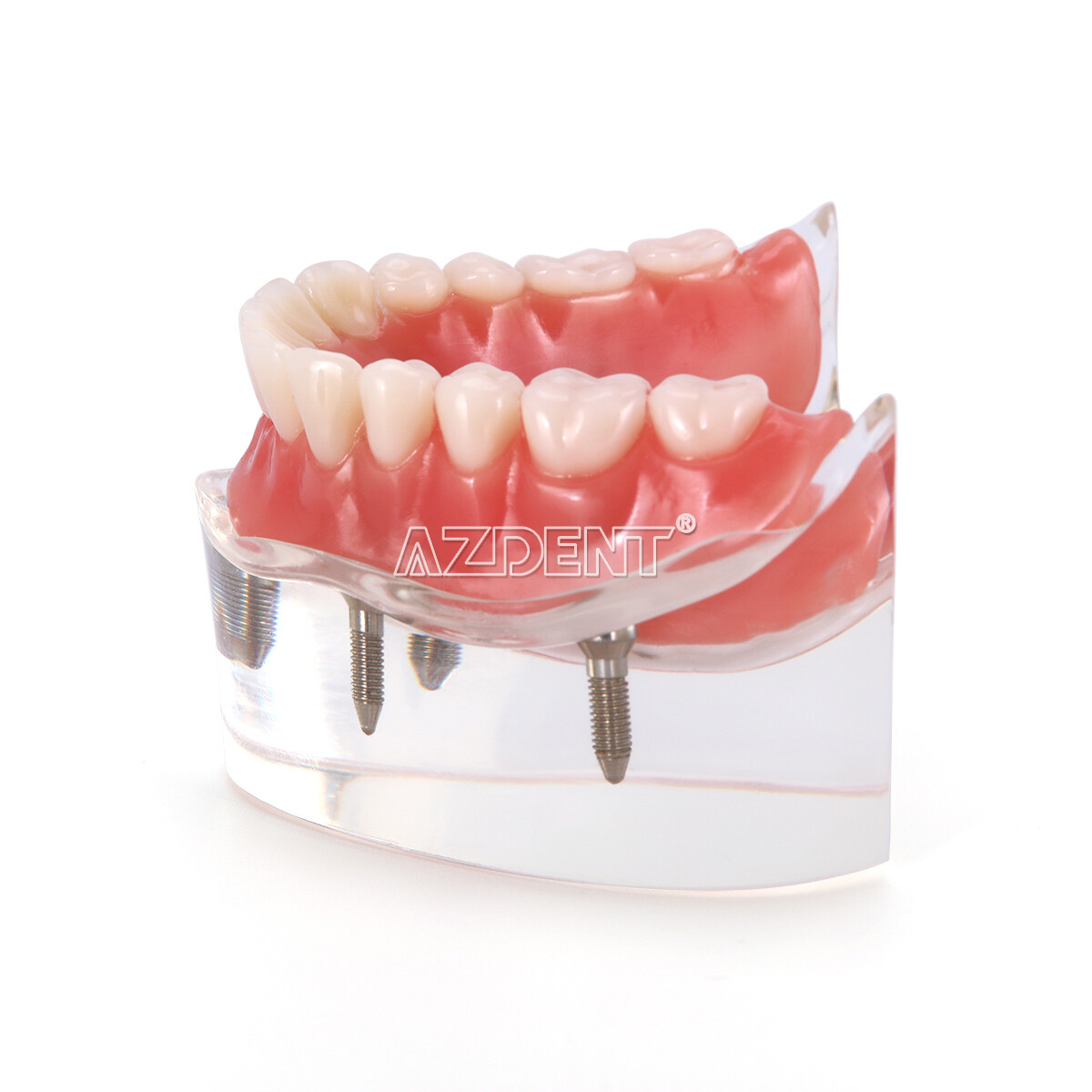 Dental Demonstration 4 Implants Teeth Model Typodont Inferior Overdenture Lower