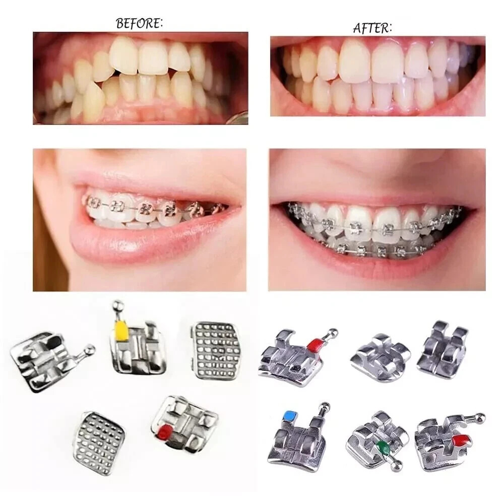 Dental Dental Orthodontic Roth/MBT/Edgewise 018»/022 3/345/No Hook Brackets