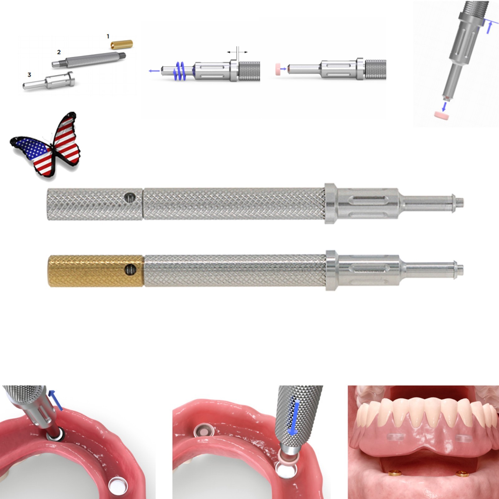 For Zest Locator Overdenture Retention Cap Set & Core Tool Insertion Removal Kit