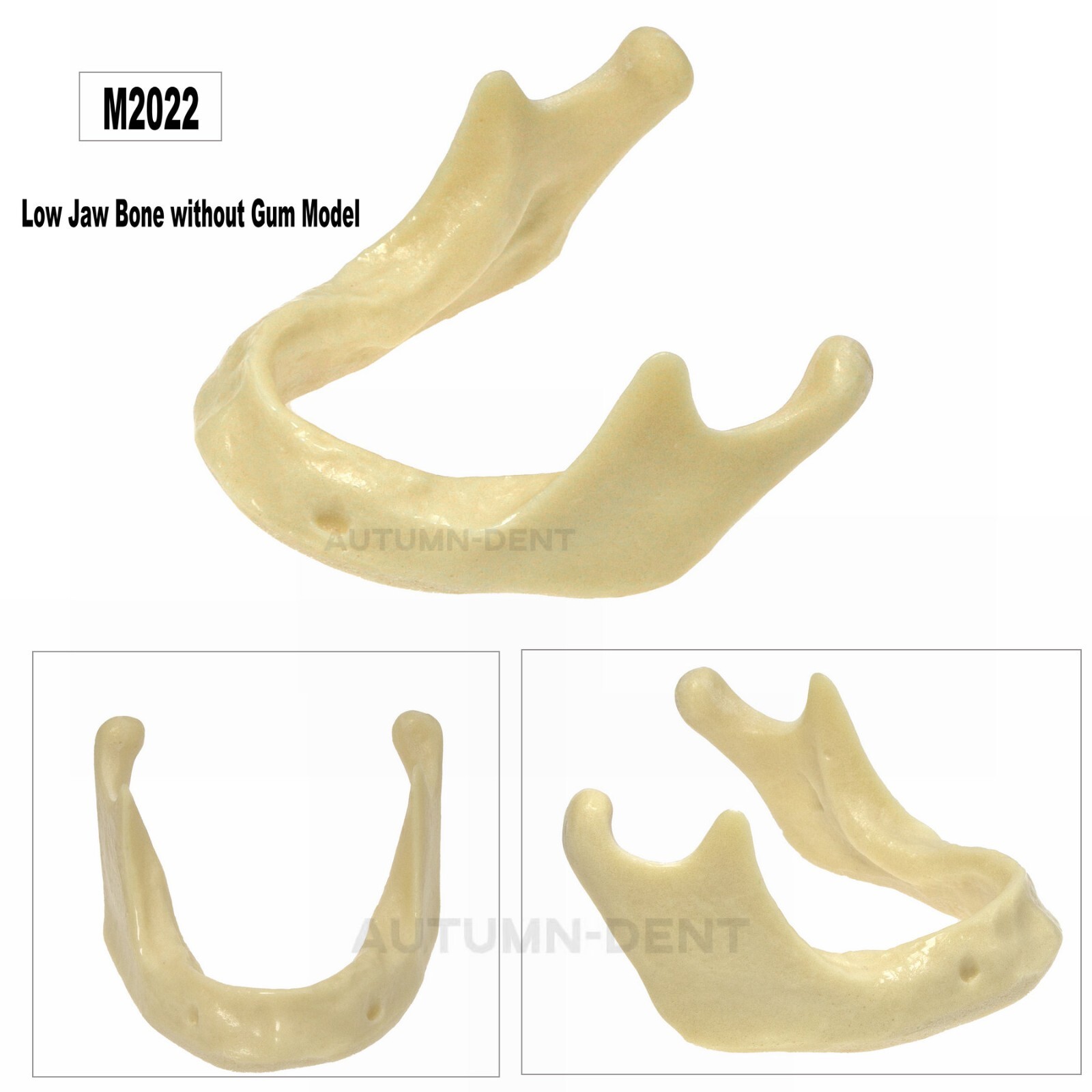 Dental Implant Mandible Jaw Model for Basic Drilling Insertion Practice M2022