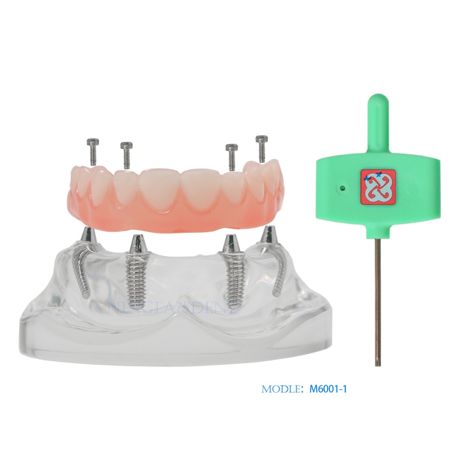 Dental All-on-4 Overdenture Implant Model, Upper/Lower Jaw-Clear,With 4 Screw