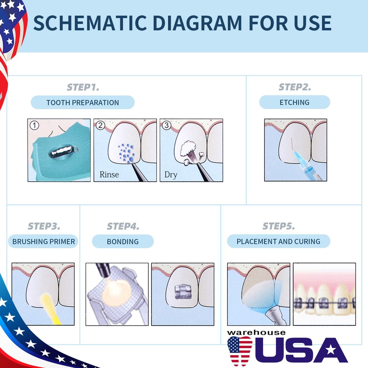 Brackets de ortodoncia dental Brackets Light-Cure Adhesivo Resina Gel Kit
