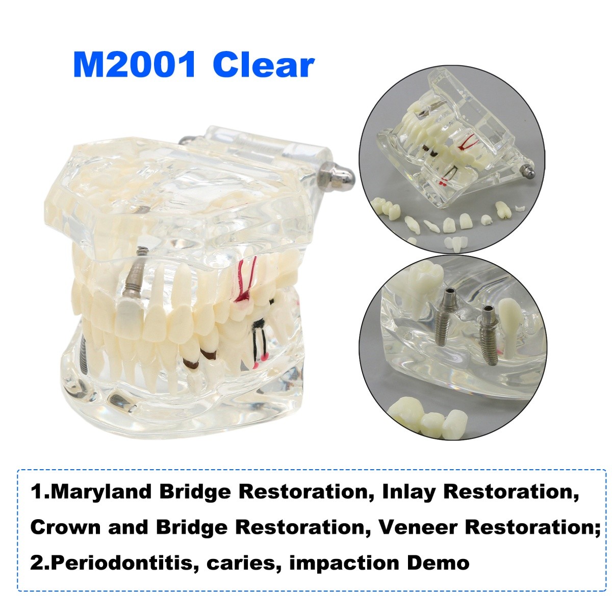 US Dental Teeth Model Implant Periodontal Disease Suture Drilling Teaching Demo