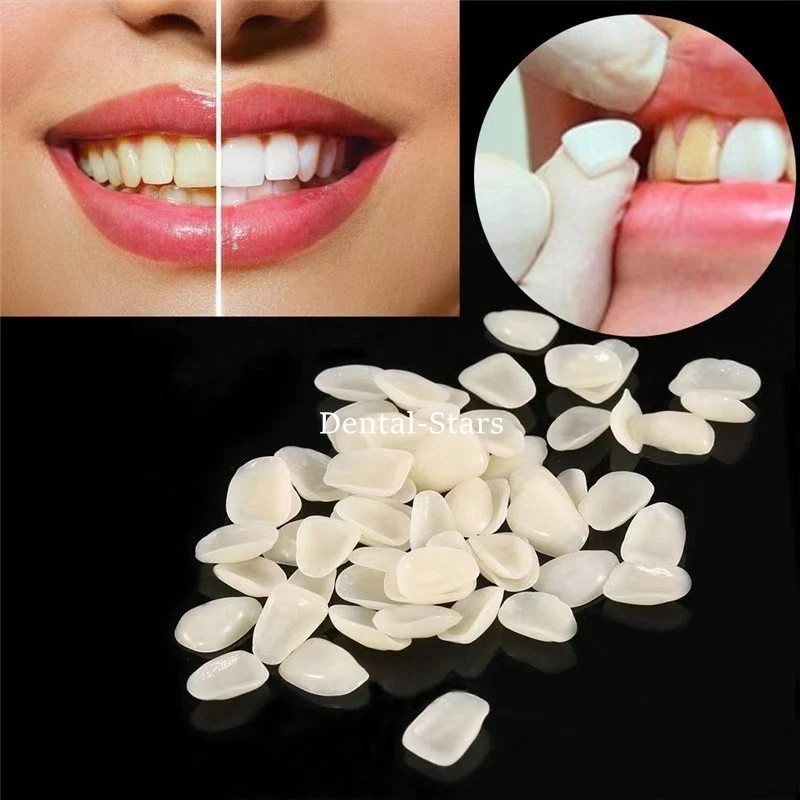 50 Pcs Dental Ultra Thin Whitening Porcelain Teeth Veneers Resin Teeth Anterior