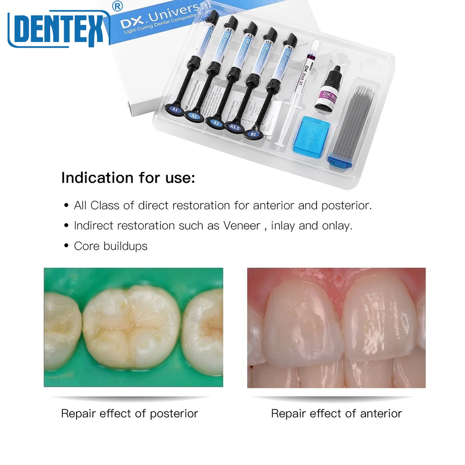 DX.Universal Dental Light Cure Composite Resin A1-B1 Etching Gel Adhesive Kit