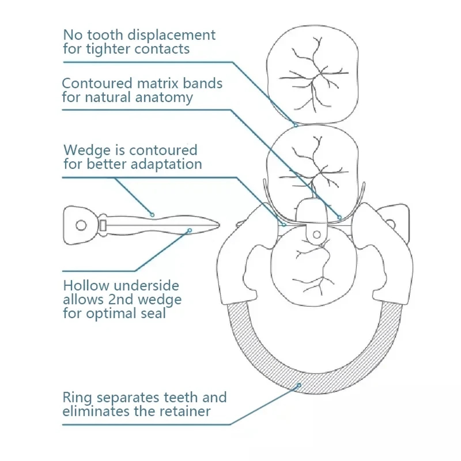 Dental Matrix Ring &Sectional Matrice Bands For Palodent V3 Garrison Dental Tool
