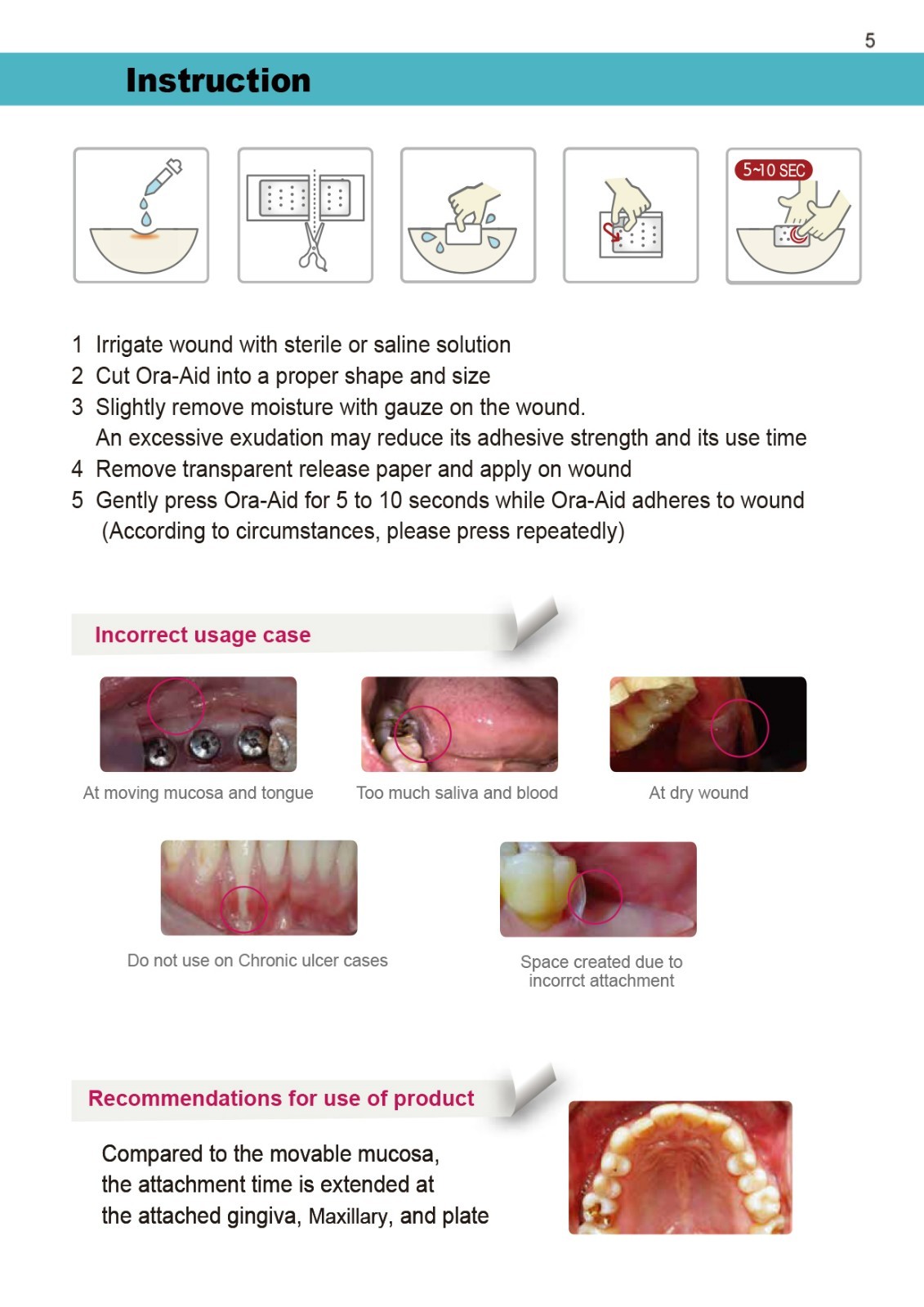 Ora-Aid for CTG & Periodontal Surgeries, Intraoral Wound Dressing 50x15mm AG-205