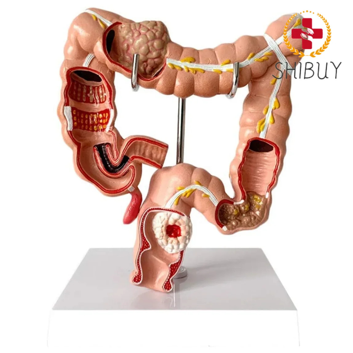 PVC Human Large Intestine Anatomical Model 1:1 Human Colonic Pathology Model