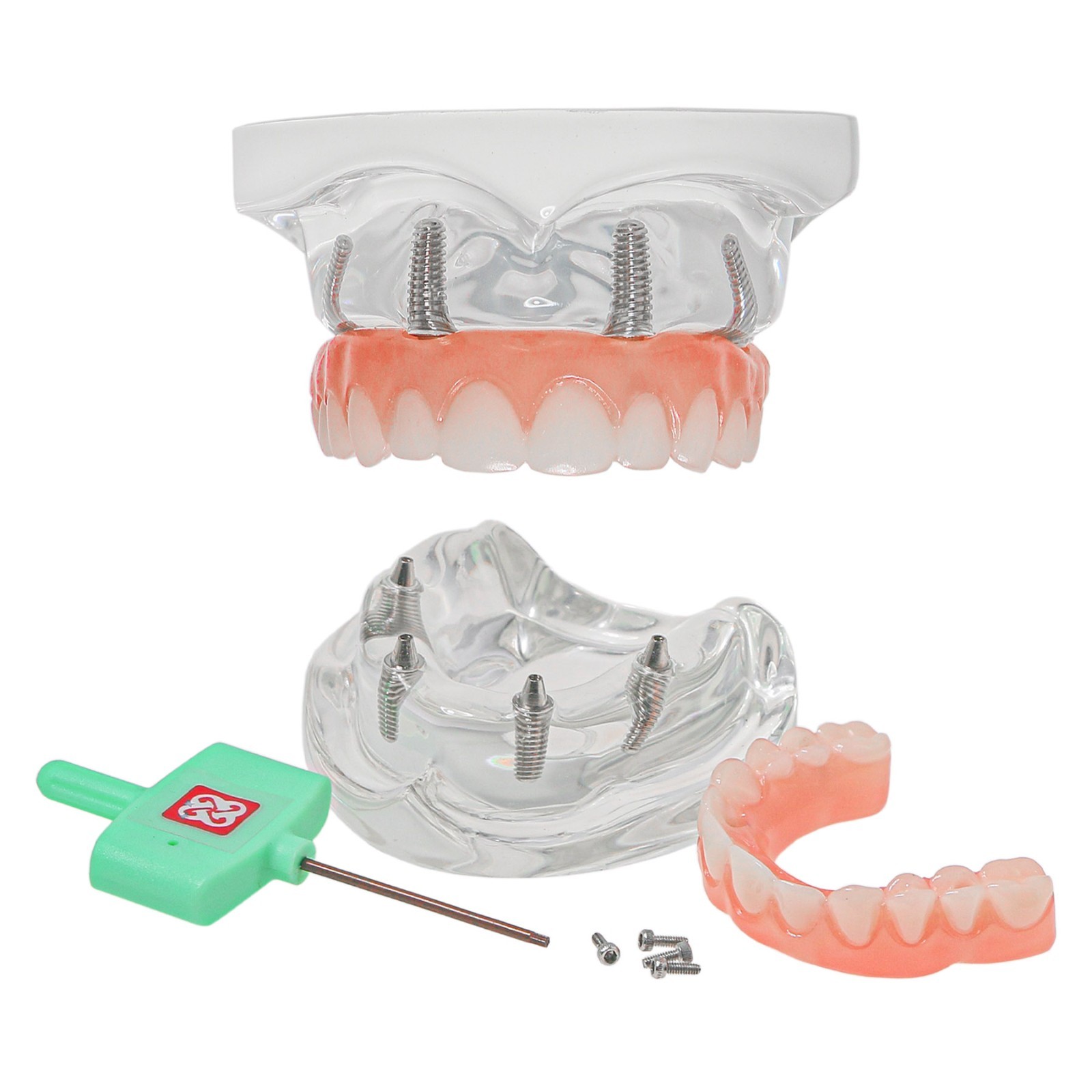 US Stock M6001‑1 All‑on‑4 Upper Jaw Implant Overdenture Demo Typodont Model