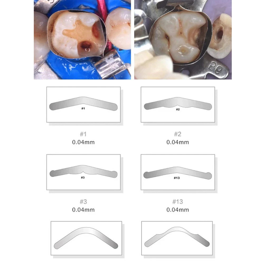 Dental Sectional Contoured Matrix Bands Ring/40 Add-On Wedges/Plier TOR VM