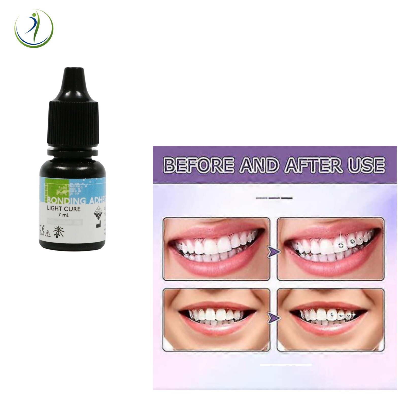 Professional Tooth Gem Rhinestone Placement Kit Stones Not Included