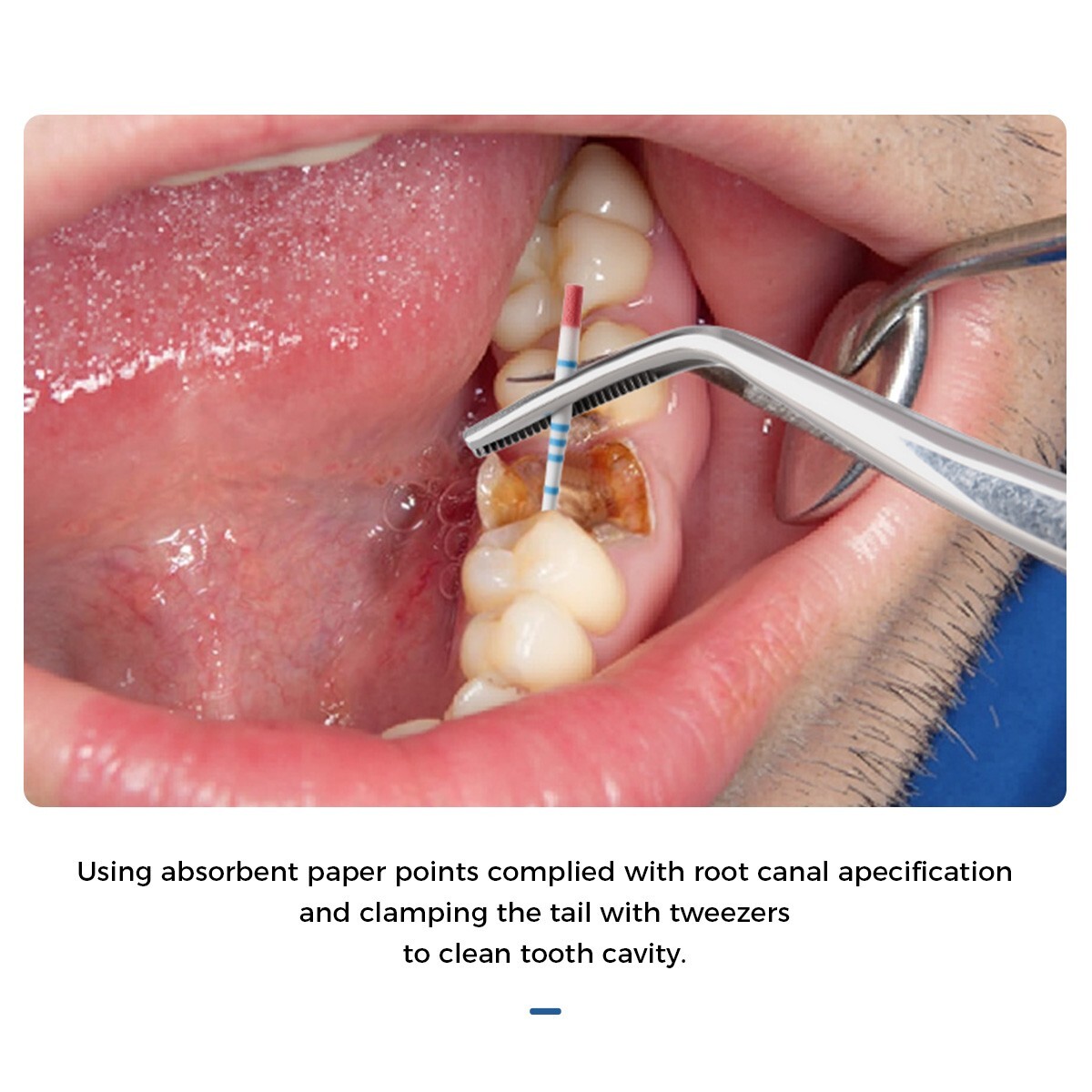 Dental Endodontics Gutta Percha Points / Absorbent Paper Points With Scale Taper