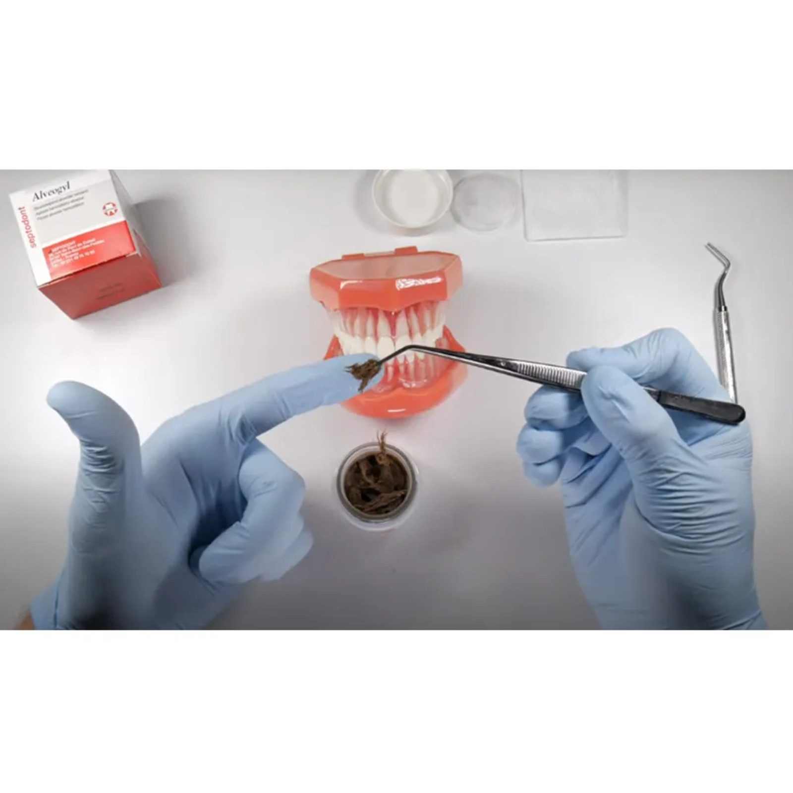 Alveogyl Septodont Alveolar Paste for Dry Socket Treatment – 10g Professional