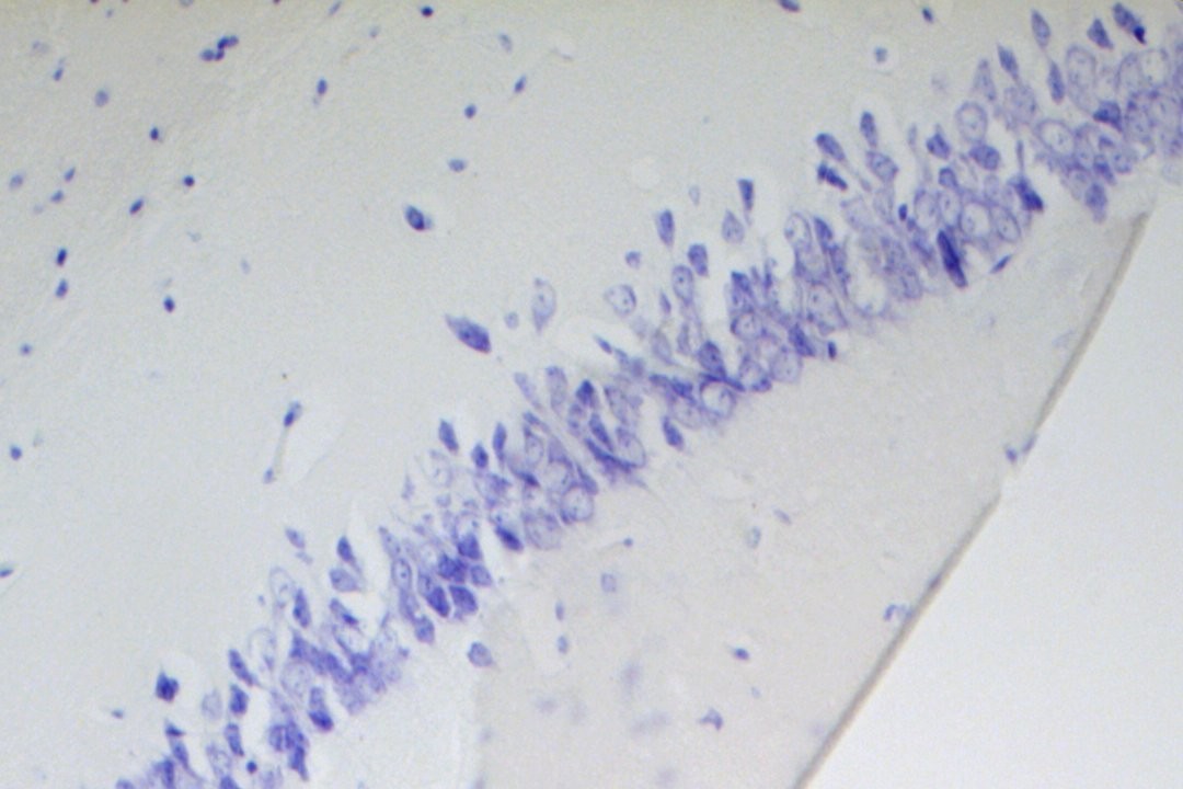 VitroView™ Nissl Stain Kit (Cat# VB-3010)