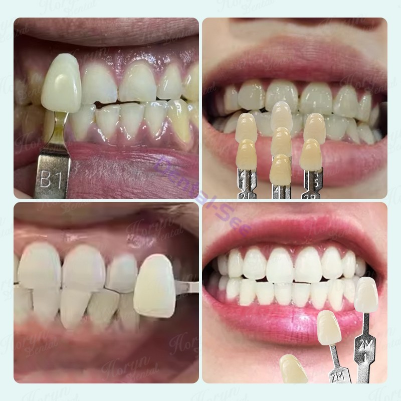 Dental VITA Toothguide 3D Master with Bleached Shade Guide Resin 29 Colors
