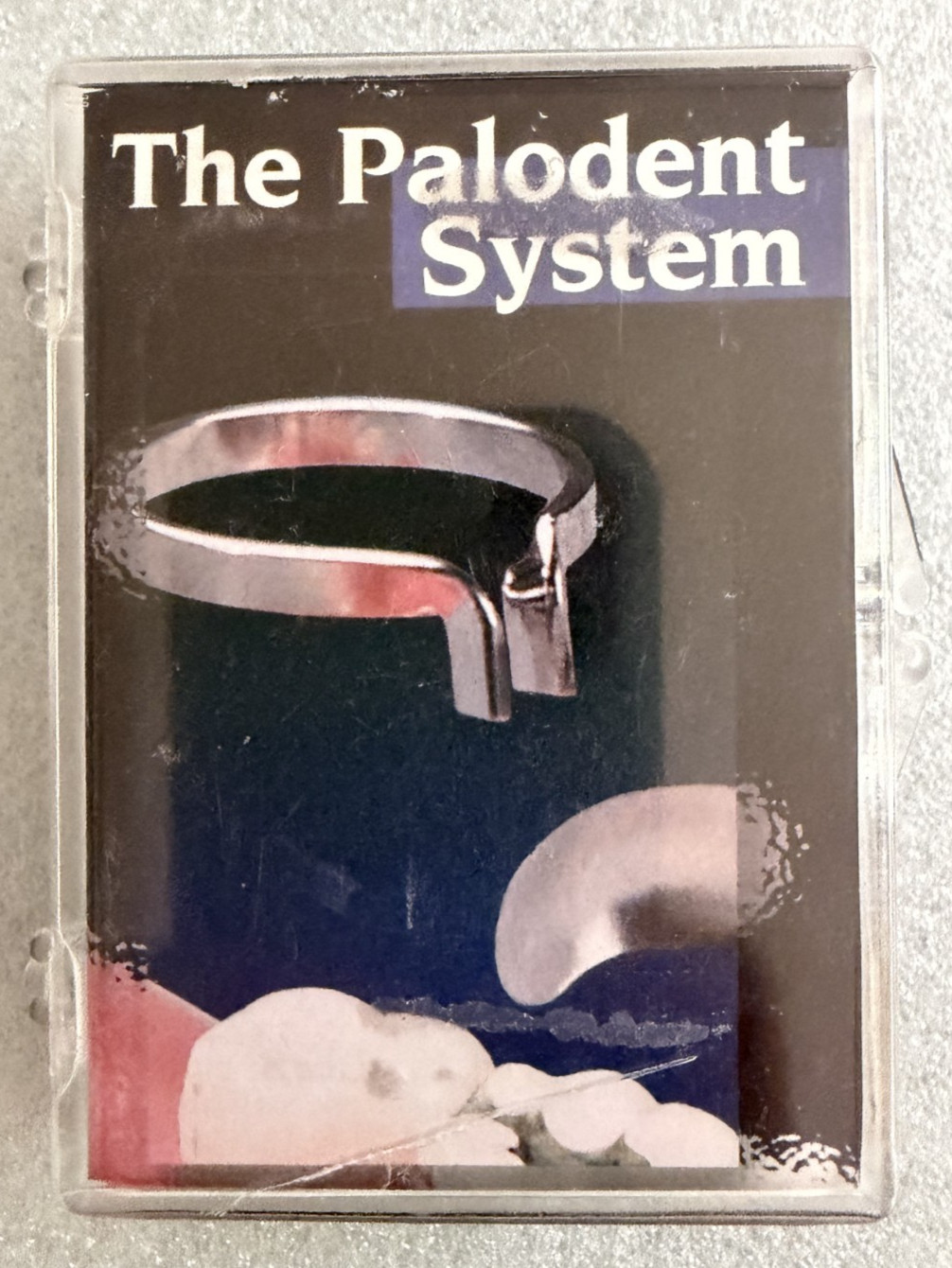 Dentsply Palodent Matrix System- 2 BiTine Rings and 50 Matrices