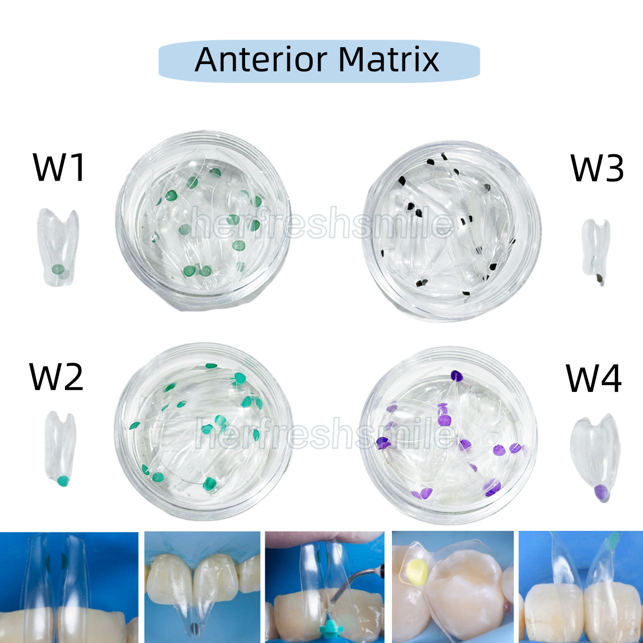 Dental Clear Matrix Transparent Restoration BT Bow Matrices Contoured BioClear