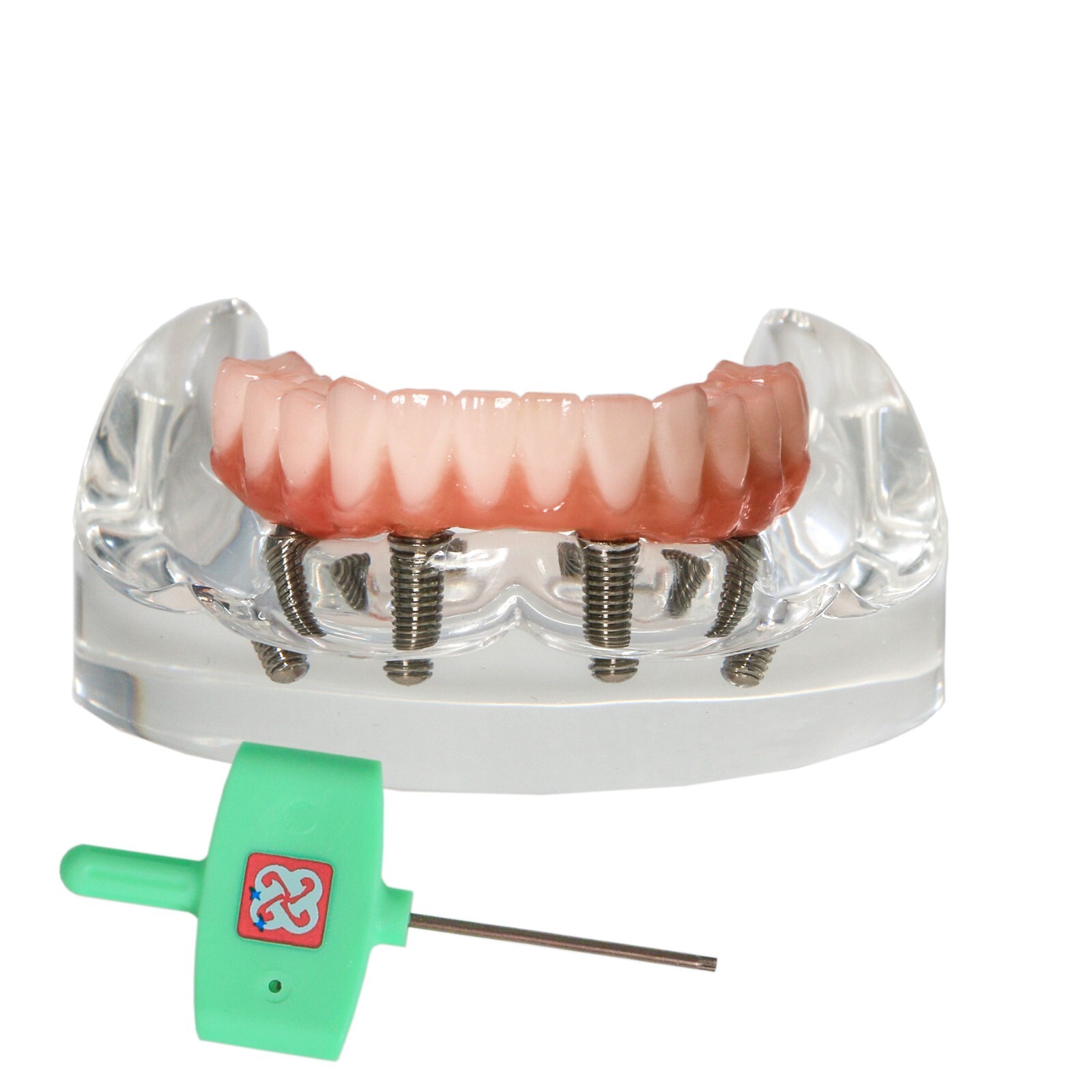 Dental All-on-4 Overdenture Implant Model, Upper/Lower Jaw-Clear,With 4 Screw