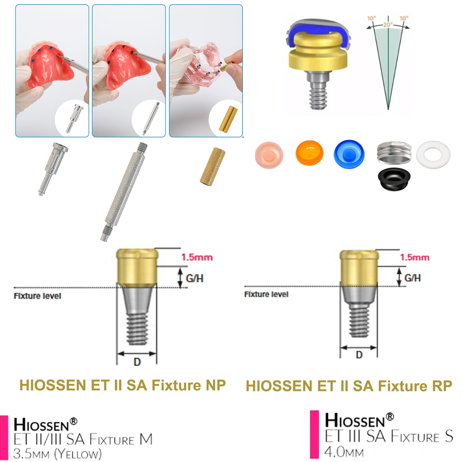Hiossen ET Locator Overdenture Abutment Male Cap fit Osstem Mini/Regular Dio 3.7