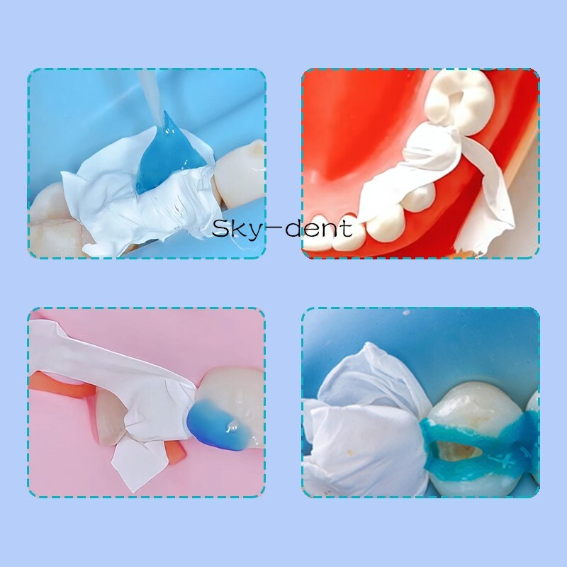 1/10Roll Dental Teflon Matrix Bands 5M/Roll PTFT White Universal Matrices System