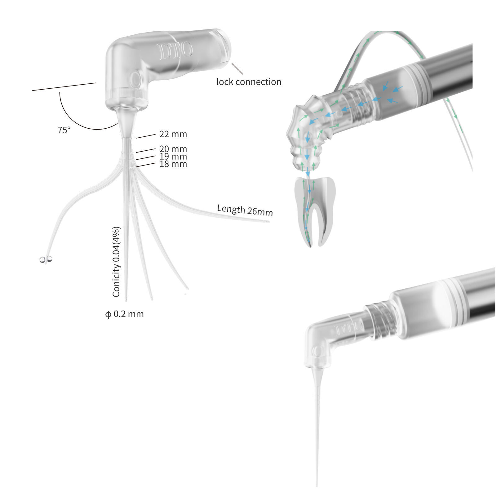 Dental Endodontic Endo Irrigation Needle Tip Disposable Root Canal Syringe Tips