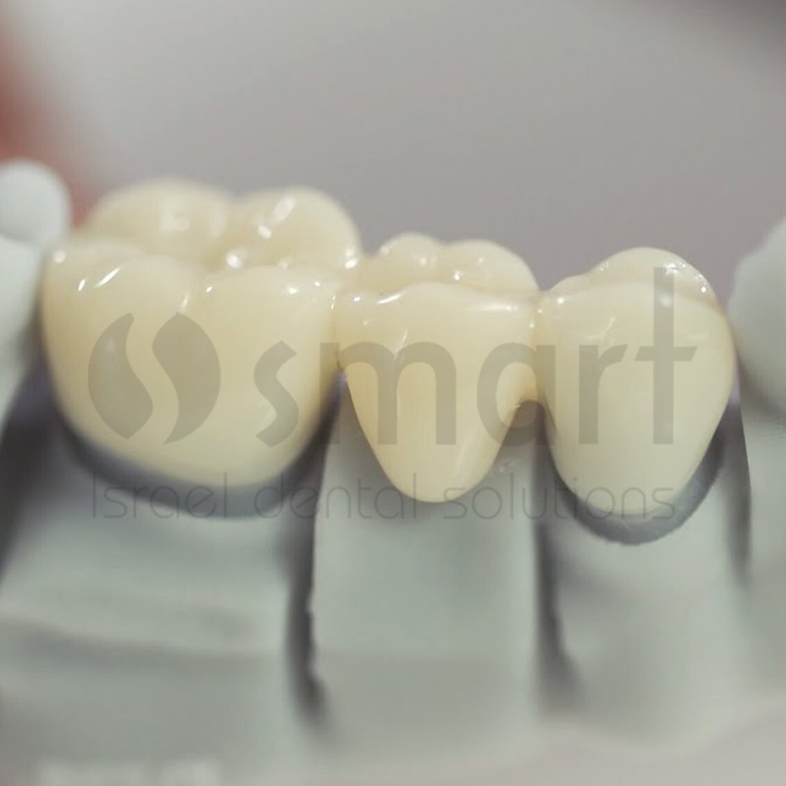 Detax Freeprint Crown 3D Printing permanent teeth 0.5L Long term bridge A2