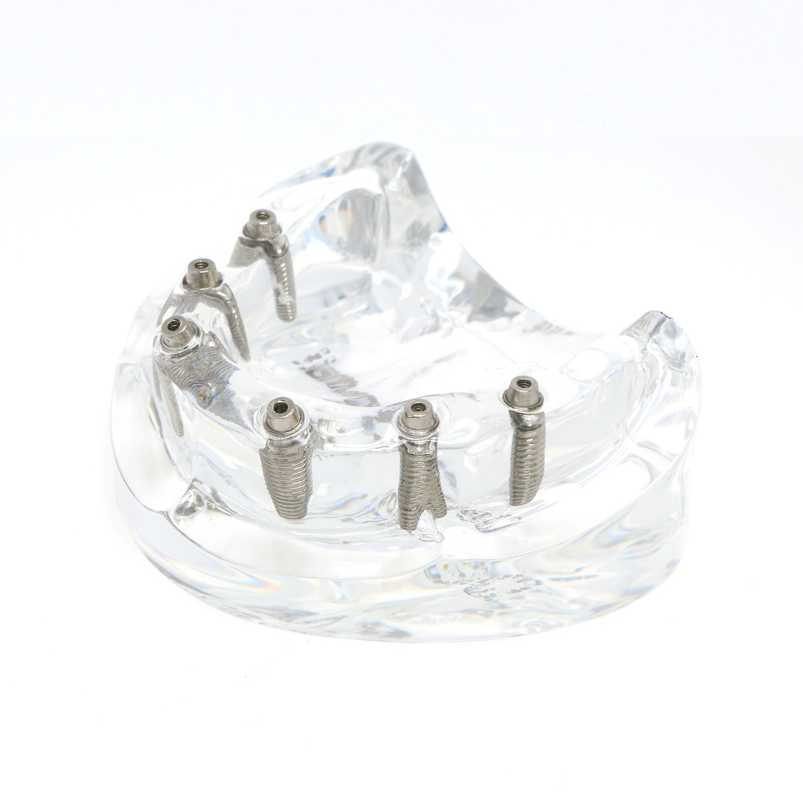 Dental Implant Overdenture Model All-On-6 Treatment Upper jaw 6 Screws, Clear US