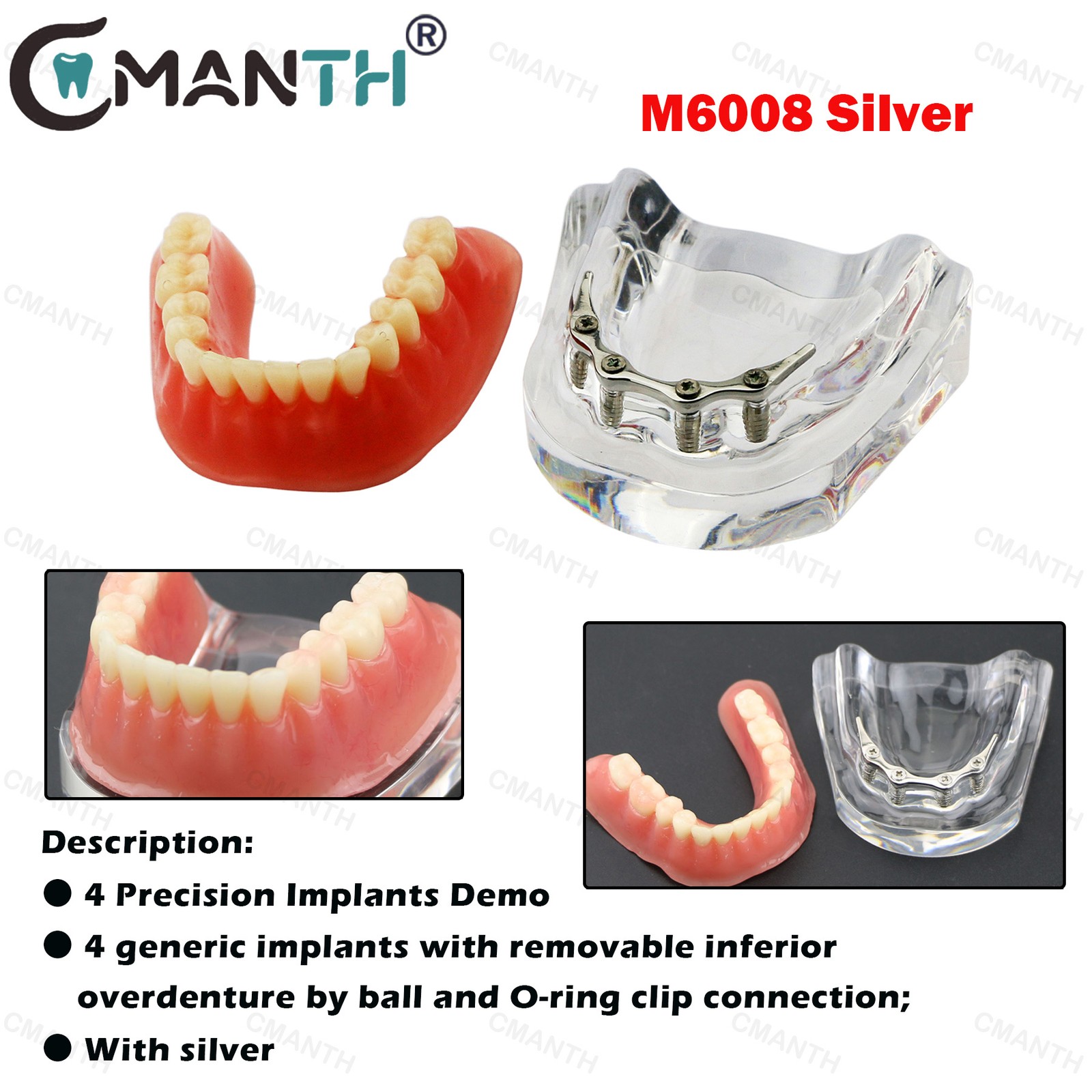 Dental Teeth Model Orthodontic Model Teaching Studying Implant Models Dental Lab